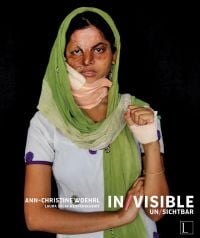 Young female with acid injuries to face, green scarf around head, on black cover of 'In/Visible', by Edition Lammerhuber.
