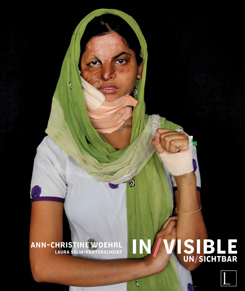 Young female with acid injuries to face, green scarf around head, on black cover of 'In/Visible', by Edition Lammerhuber.