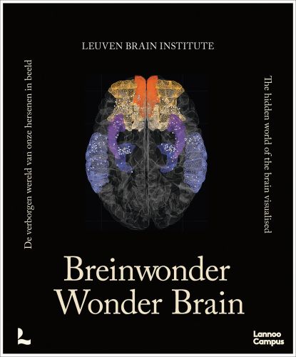 Wonder Brain