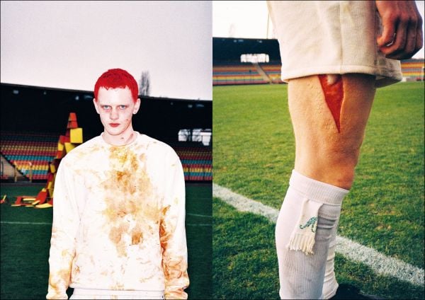 Book cover of Marianna Simnett: Winner, with a person shouting; blood dripping down face. Published by Silvana.