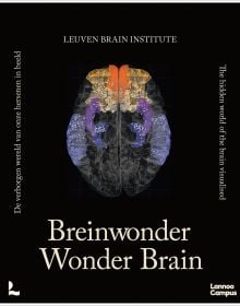 Wonder Brain