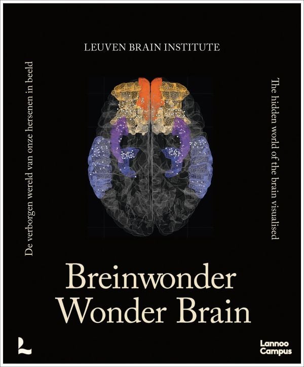 Wonder Brain