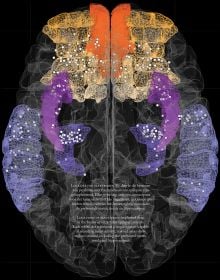 Wonder Brain