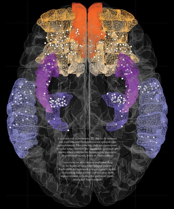 Wonder Brain