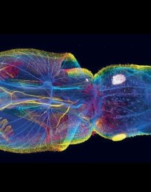 Wonder Brain