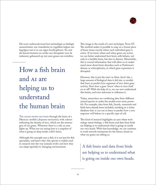 Wonder Brain