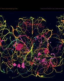 Wonder Brain